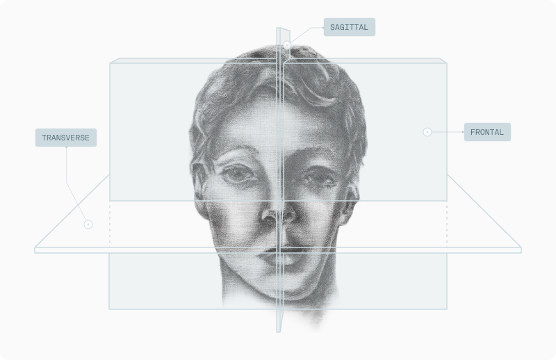 Side-view illustration of hemifacial microsomia with sagittal, frontal and transverse craniofacial planes