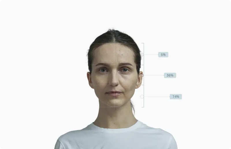 Front portrait with asymmetry percentages annotated across the upper, middle and lower thirds (5%, 36%, 74%)