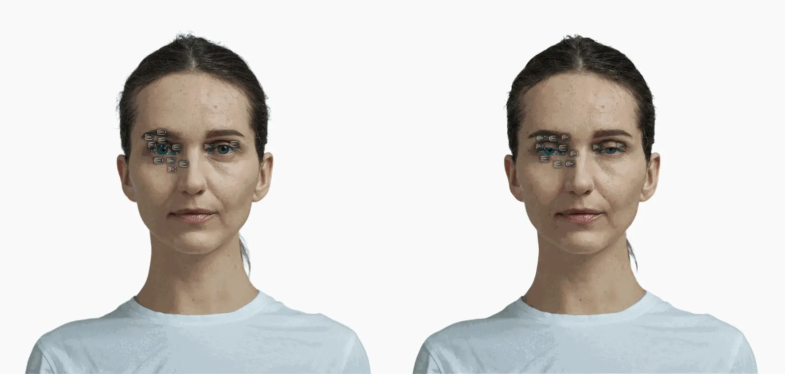 Eye Aspect Ratio (Almondness Ratio) before-and-after comparison on a female frontal portrait