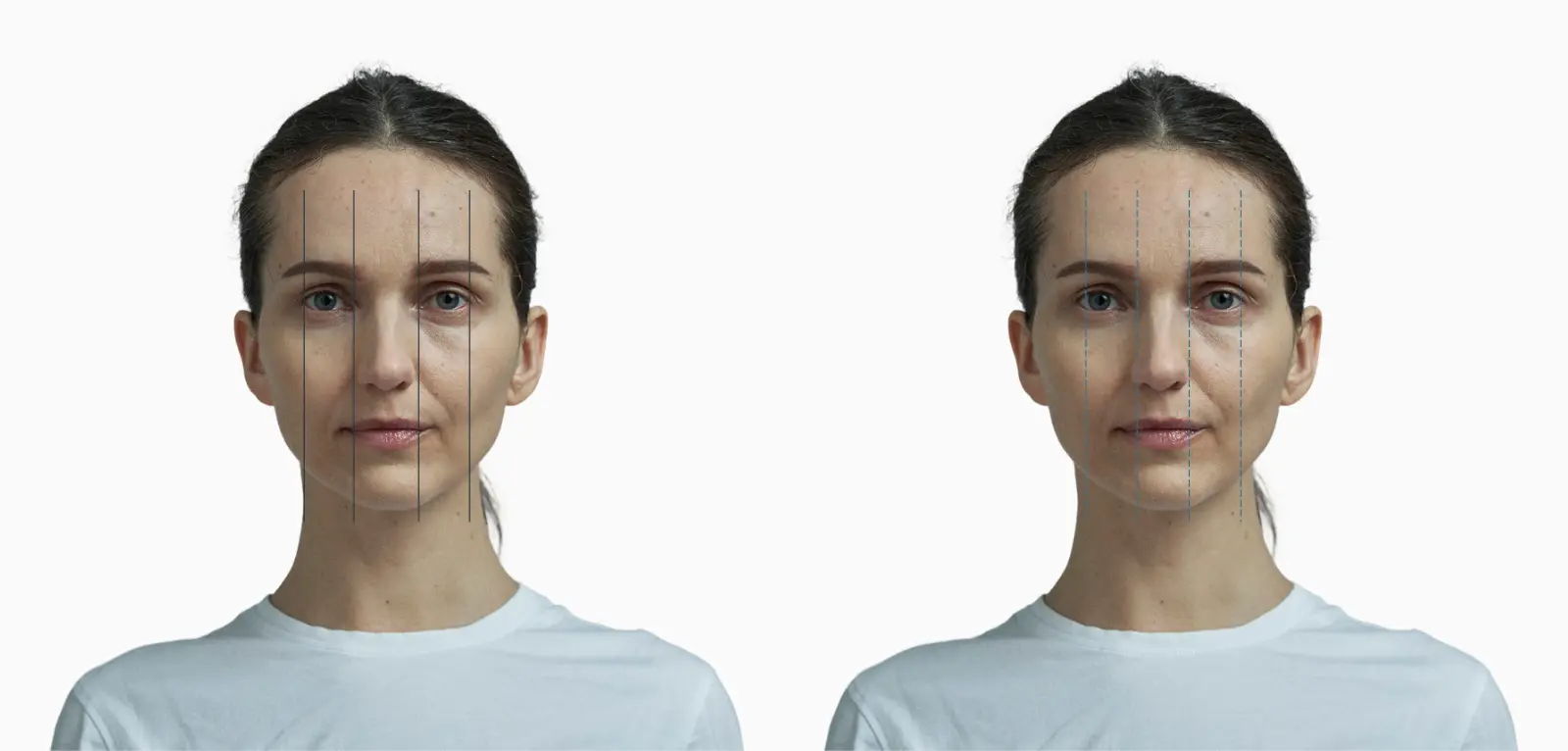 Facial fifths before and after: the real unequal fifths on the left versus an ideal equal-width five-band grid on the right, same female face