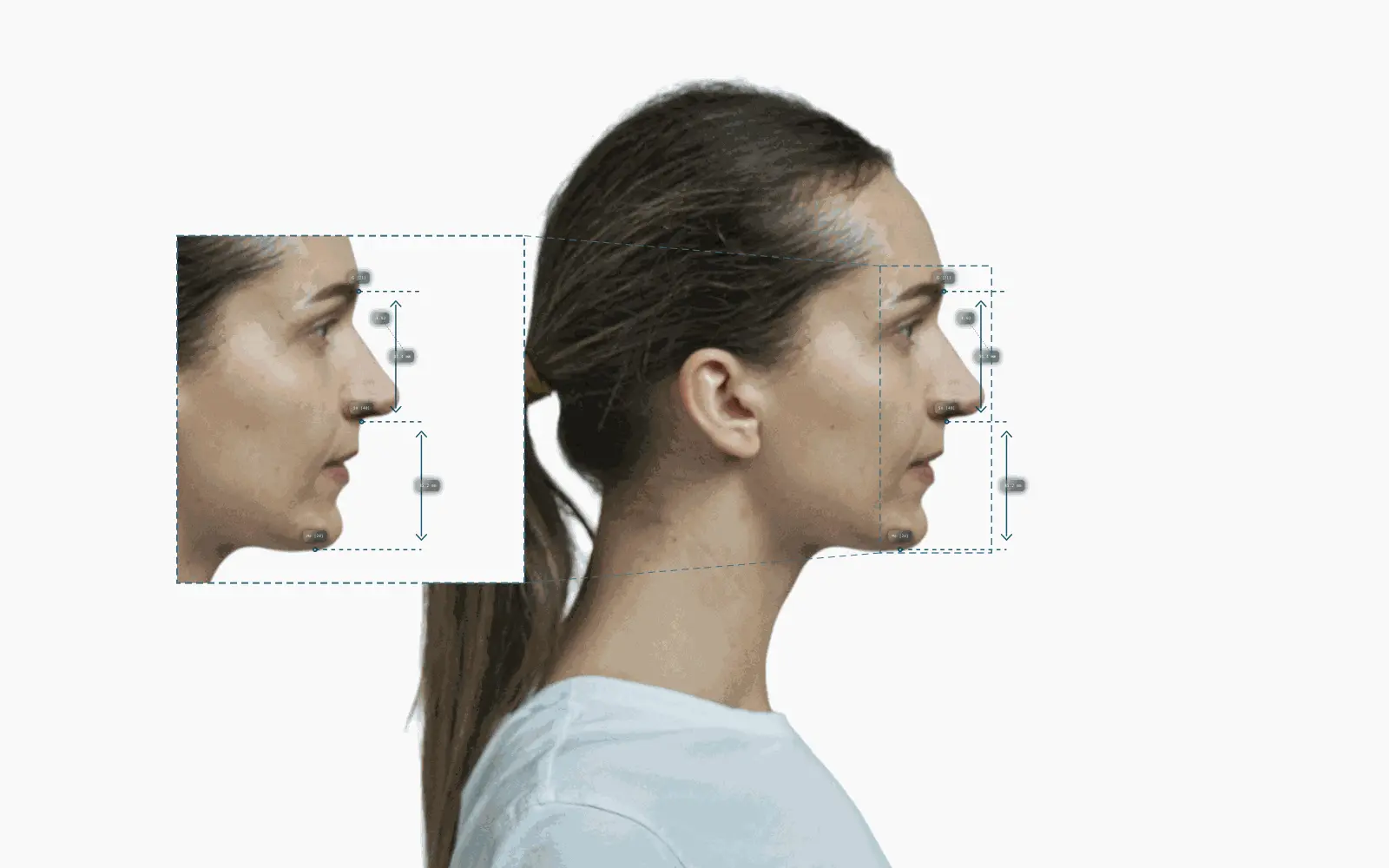 Facial thirds annotated on a female right-profile portrait
