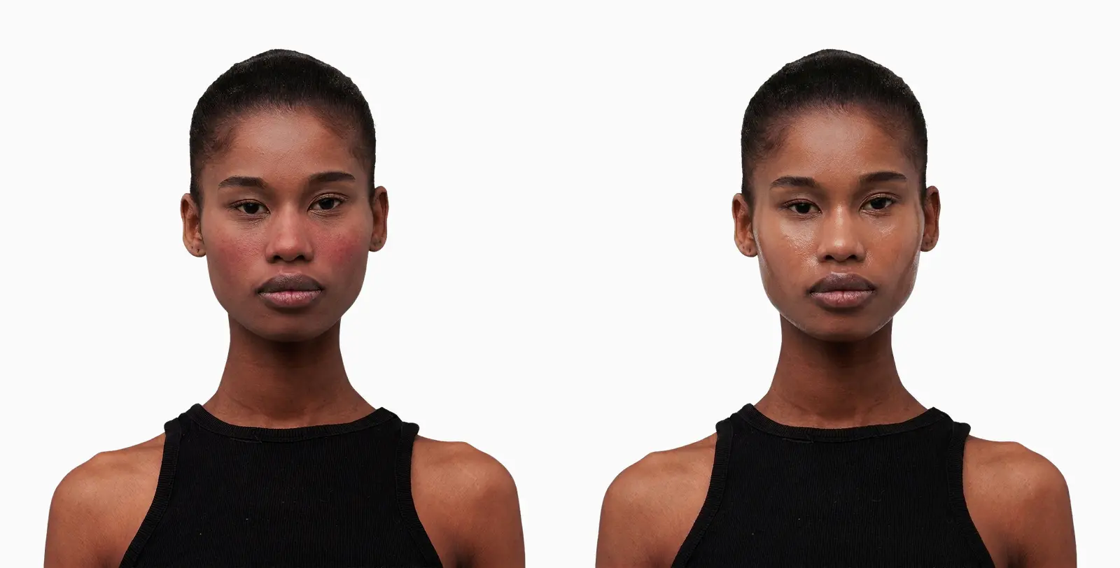 Dull, dehydrated skin before and after an oxygen facial
