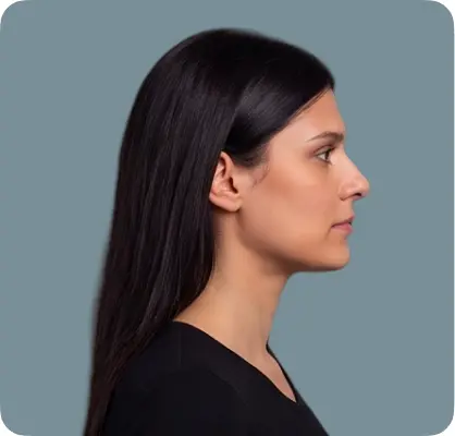 Face profile study 11