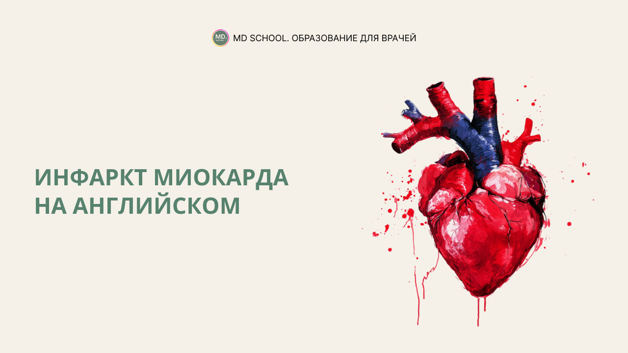 Картинка статьи Инфаркт миокарда на английском