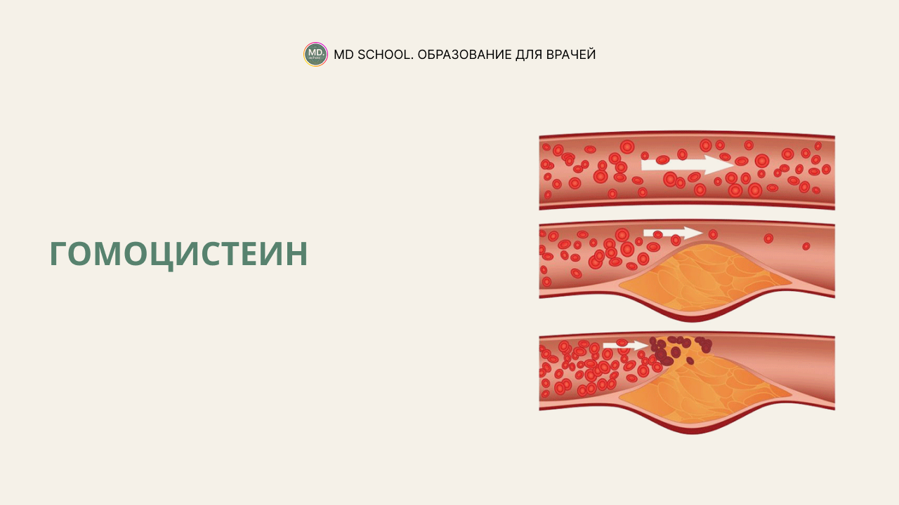 Картинка статьи Гомоцистеин