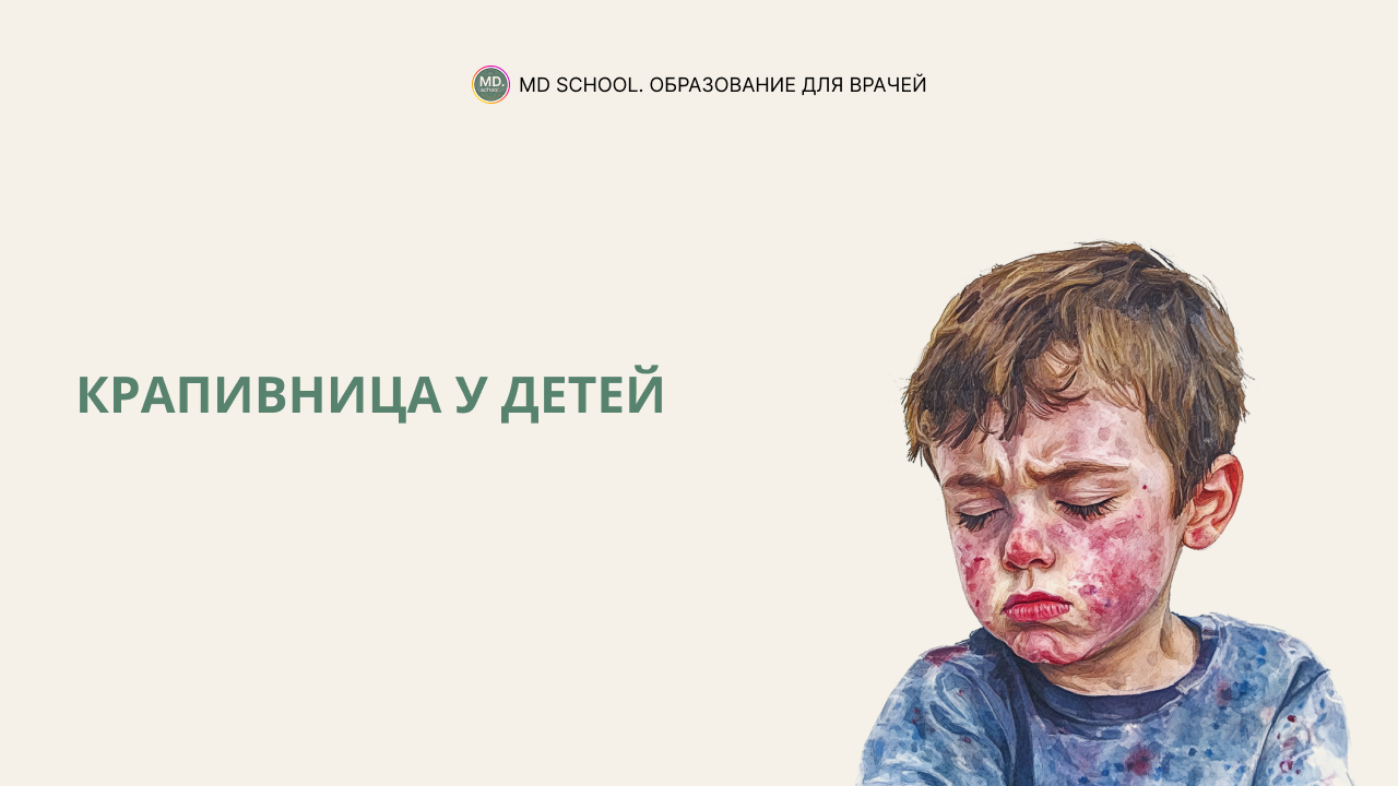 Картинка статьи Крапивница у детей