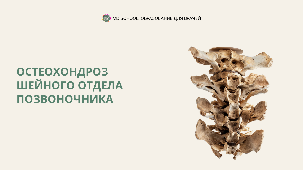 Картинка статьи Остеохондроз шейного отдела позвоночника