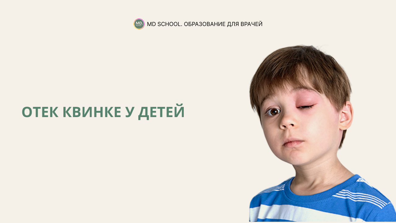 Картинка статьи Отек Квинке у детей