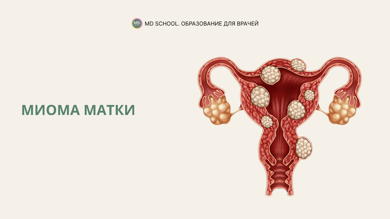 Диагностика и лечение фибромы матки в Нижнем Новгороде | ТОНУС ПРЕМИУМ