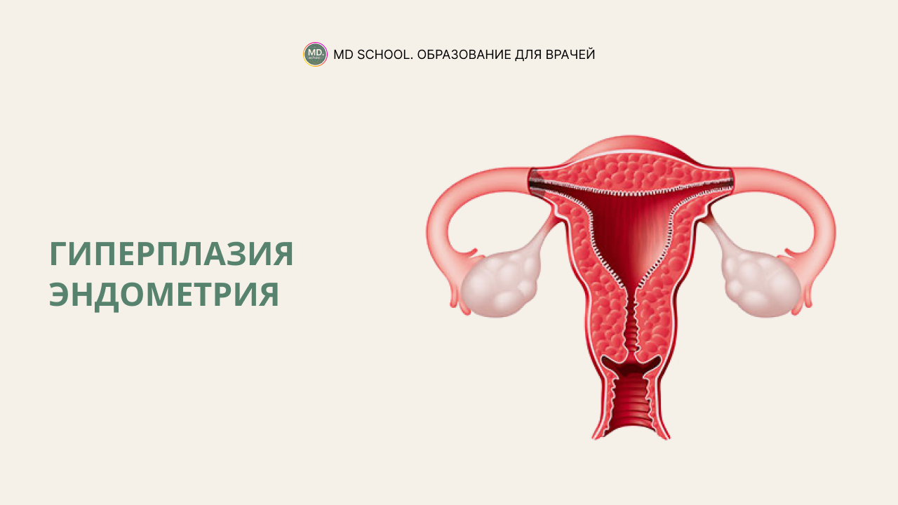 Гиперплазия эндометрия — причины, симптомы и лечение заболевания в клинике «Альфа-Центр Здоровья»