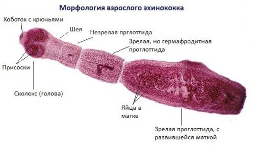 Эхинококкоз - причины появления, симптомы заболевания, диагностика и способы лечения