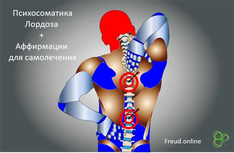 Психосоматика лордоза, аффирмации для самолечения