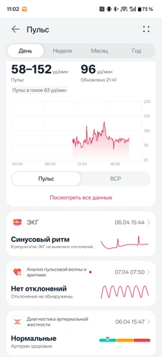 Обзор смарт-часов Huawei Watch GT Runner 2: спорт, стиль и автономность