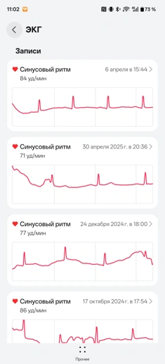 Обзор смарт-часов Huawei Watch GT Runner 2: спорт, стиль и автономность