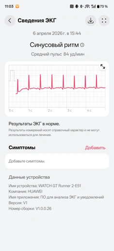 Обзор смарт-часов Huawei Watch GT Runner 2: спорт, стиль и автономность