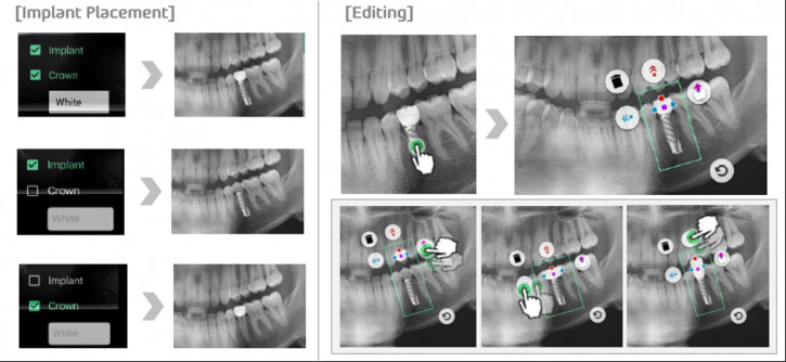 Планшеты Samsung помогают стоматологам при рентгене