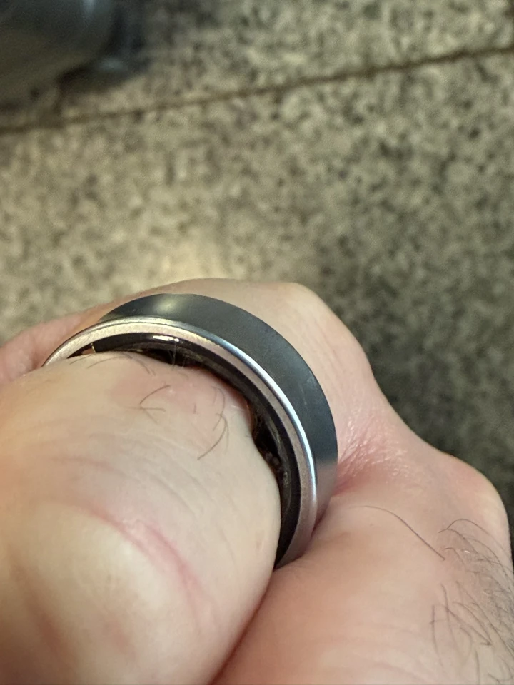 Батарея кольца Samsung Galaxy Ring вздулась прямо на пальце владельца