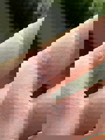 Финал истории о кольце Samsung Galaxy Ring со вздувшейся на пальце батареей