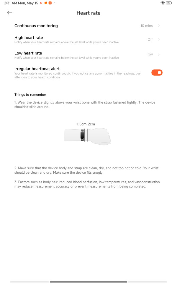 Обзор Xiaomi Smart Band 8: эволюция снаружи, революция внутри