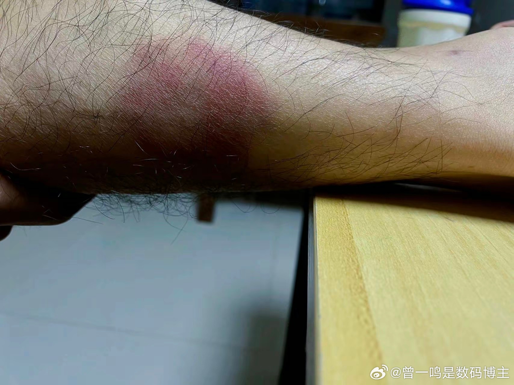 Горячая новинка: iPhone 15 Pro оставляют ожоги на руках и бёдрах