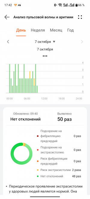 Обзор смарт-часов Huawei Watch D2: еще раз о давлении.