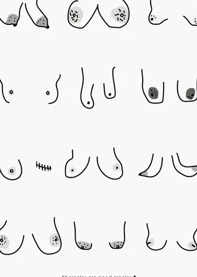 Areolas