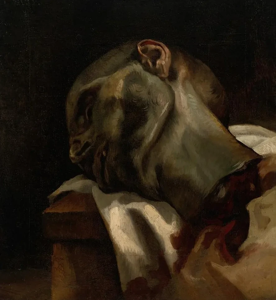Head of a Guillotined Man