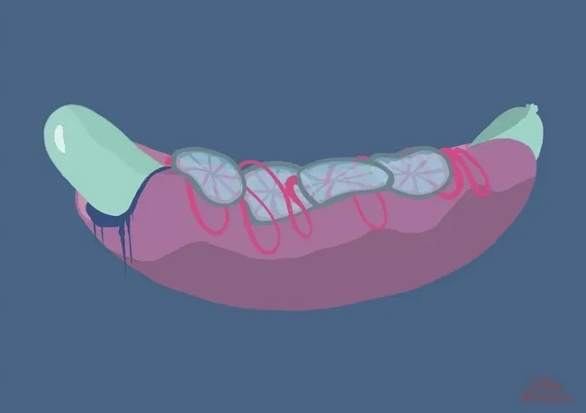 Hotdog
