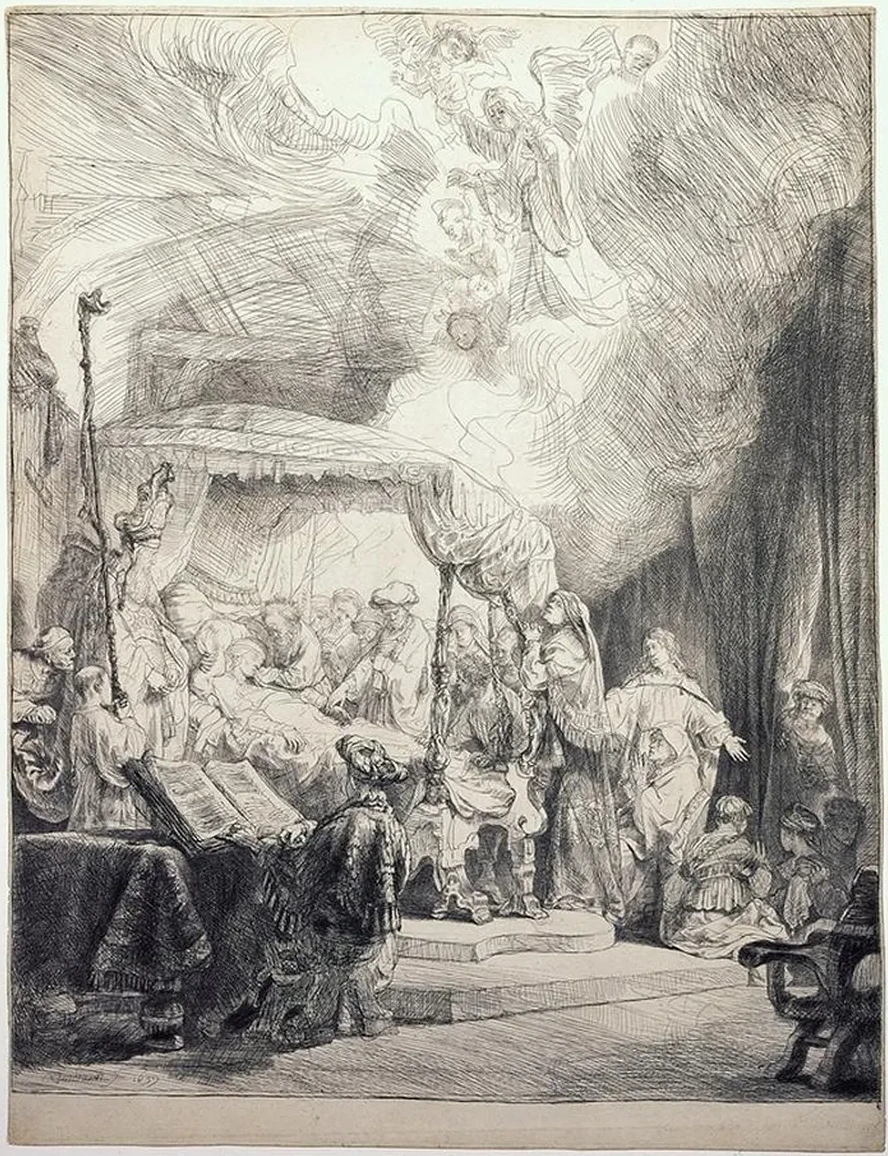 The Beggar with a Wooden Leg