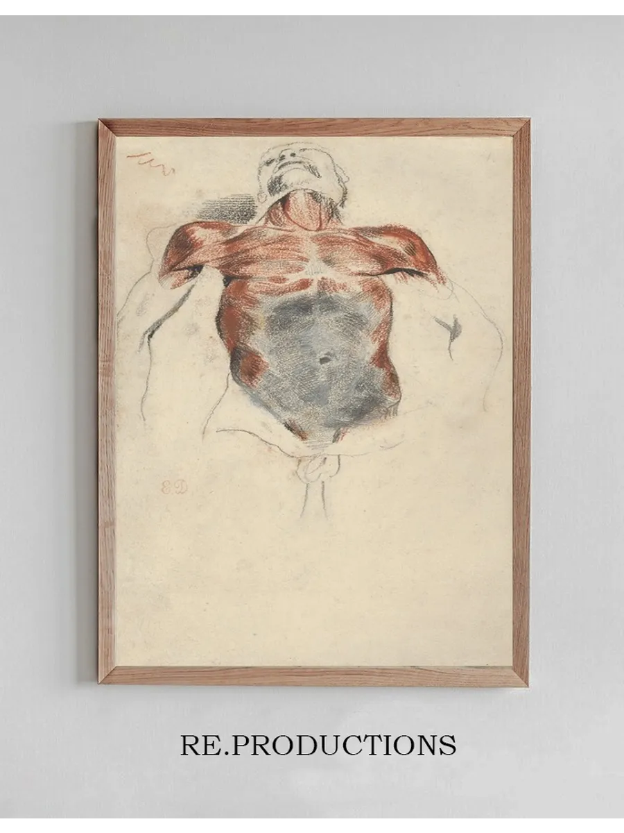 Torso of a Male Cadaver