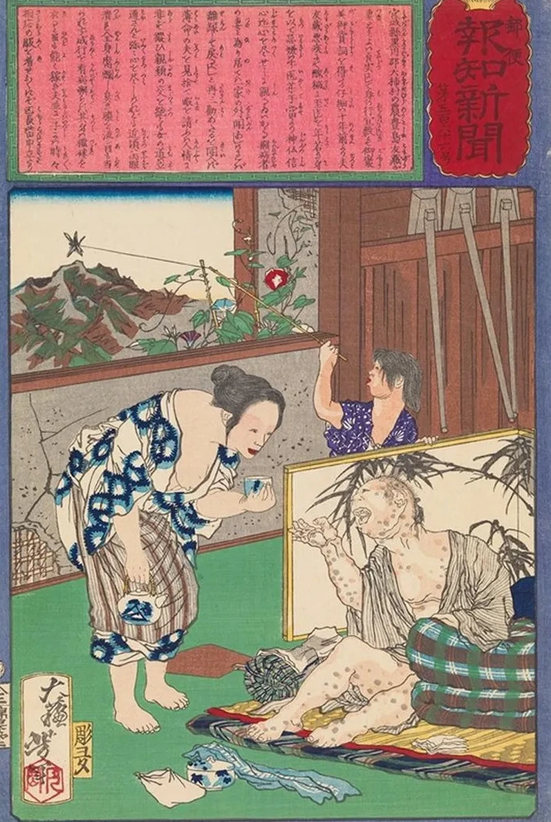 Toshima Tomiyo Who Stayed with Her Leper Husband, Tomoz