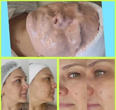 Изнаночное изображение