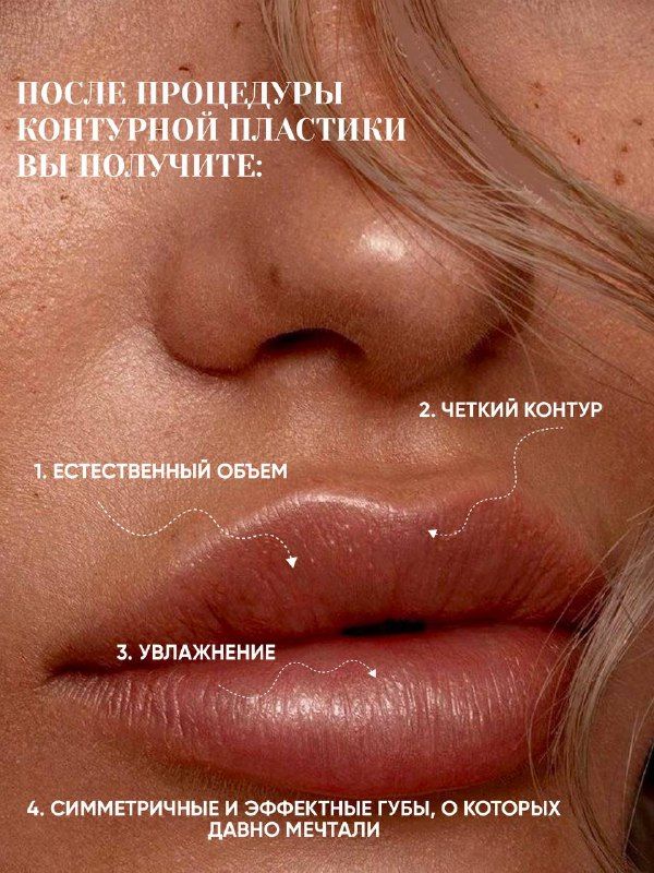 Изображение поста 2