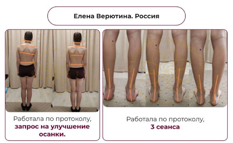 Изображение поста 2