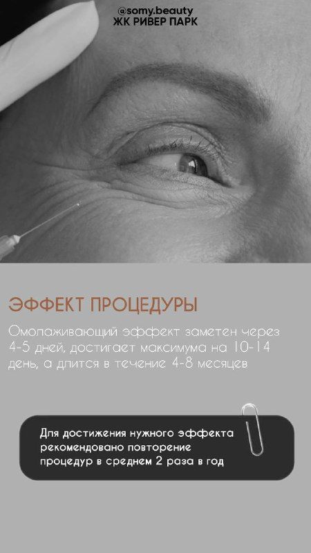 Изображение поста 2