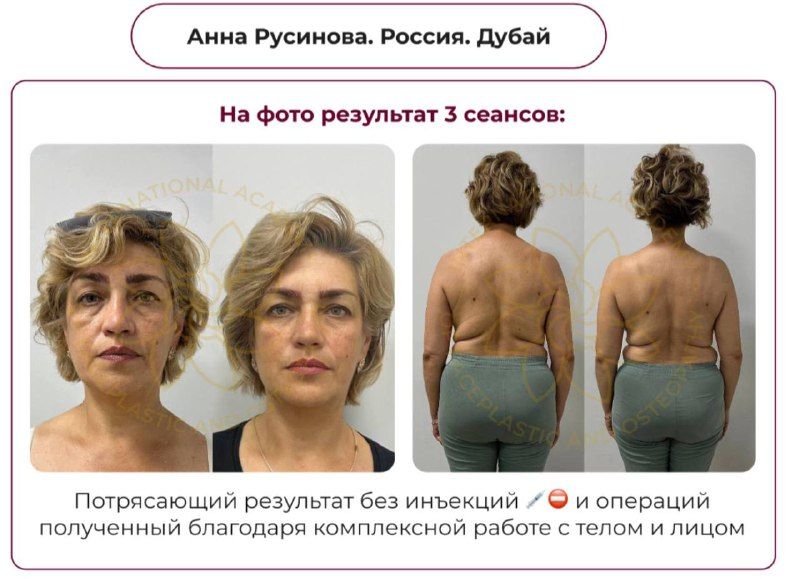 Изображение поста 1
