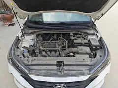 2020 Hyundai 1.4L CVT GLS, белый — фото 16