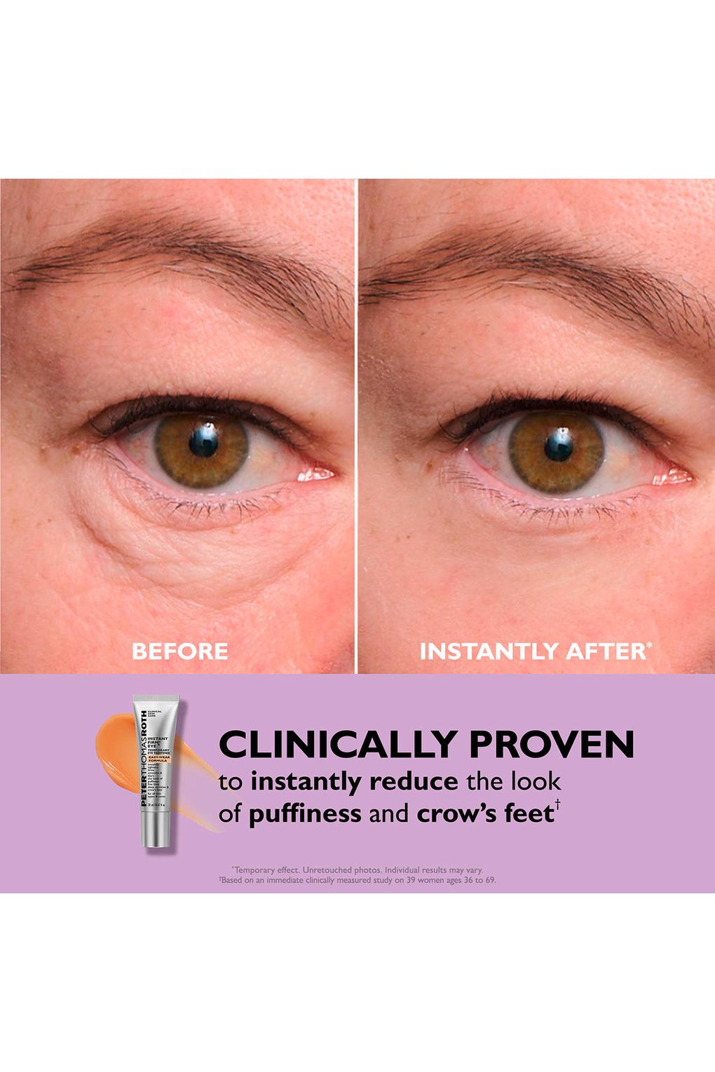 Крем для ухода за кожей Peter Thomas Roth CLINICAL SKIN CARE, 20 мл. Фото 4.