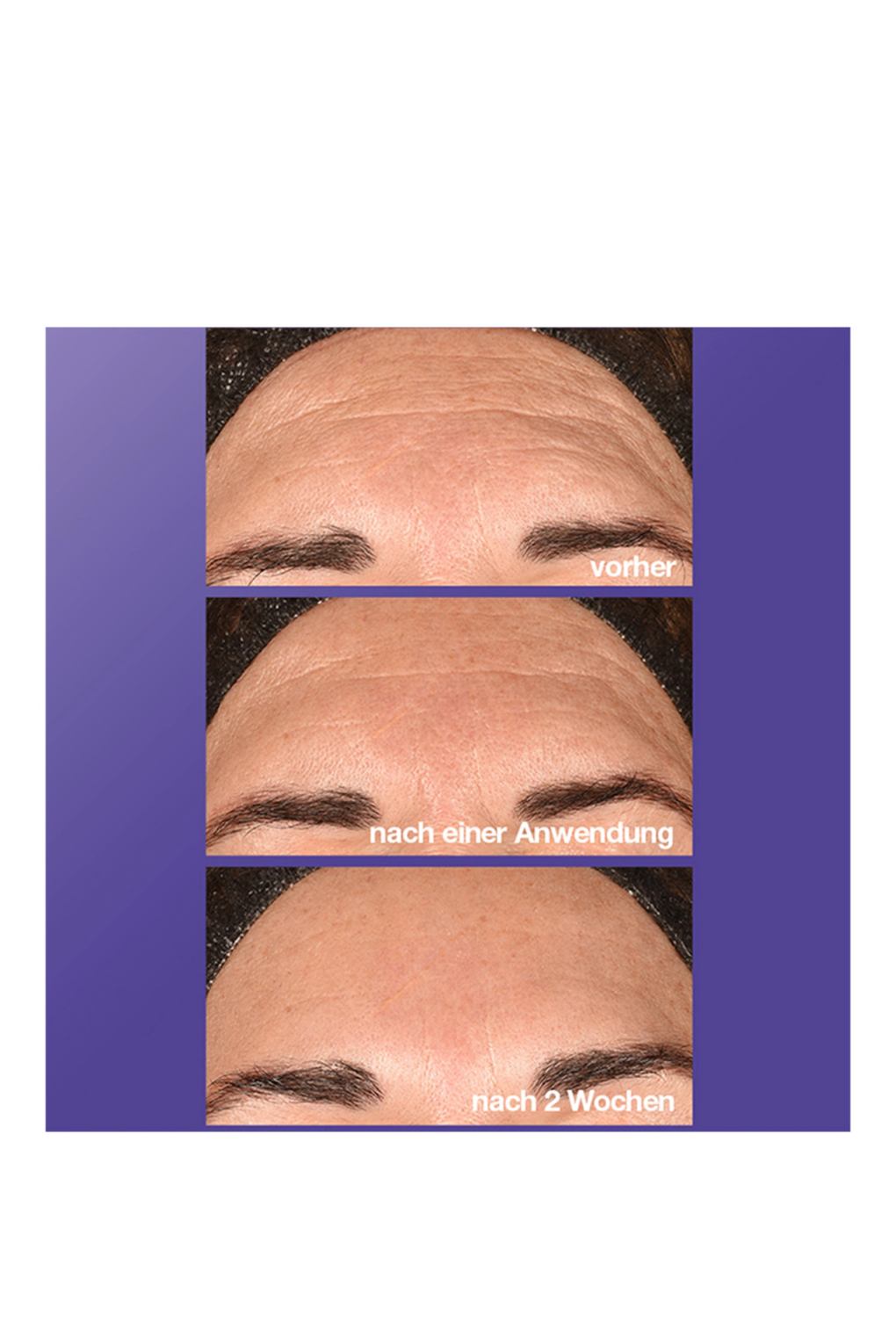 Крем для ухода за кожей Dermalogica Phyto Nature, 100 мл. Фото 4.