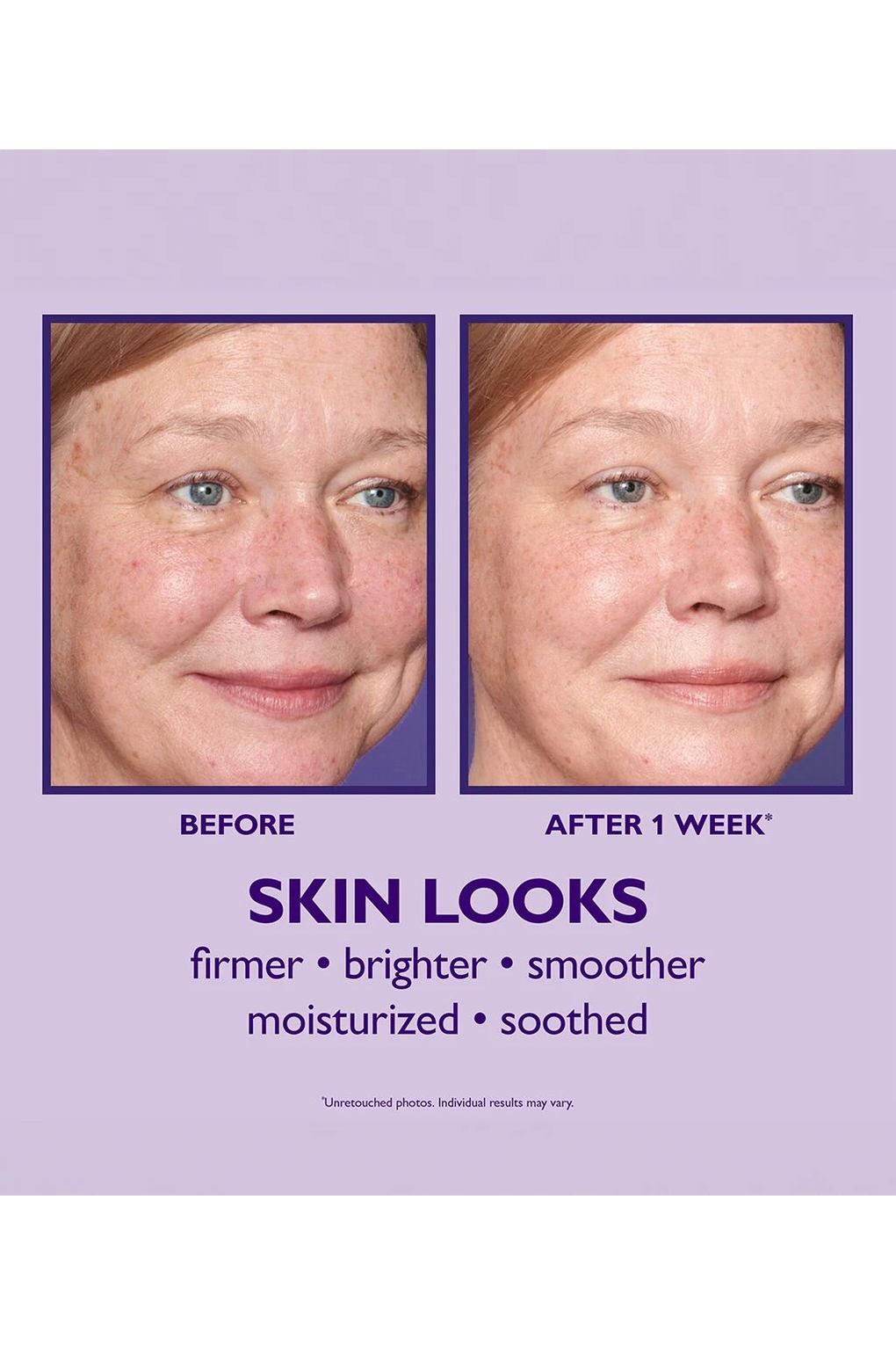 Многофункциональный увлажняющий крем для лица Peter Thomas Roth Ultimate Solution 5 , 30 мл. Фото 5.