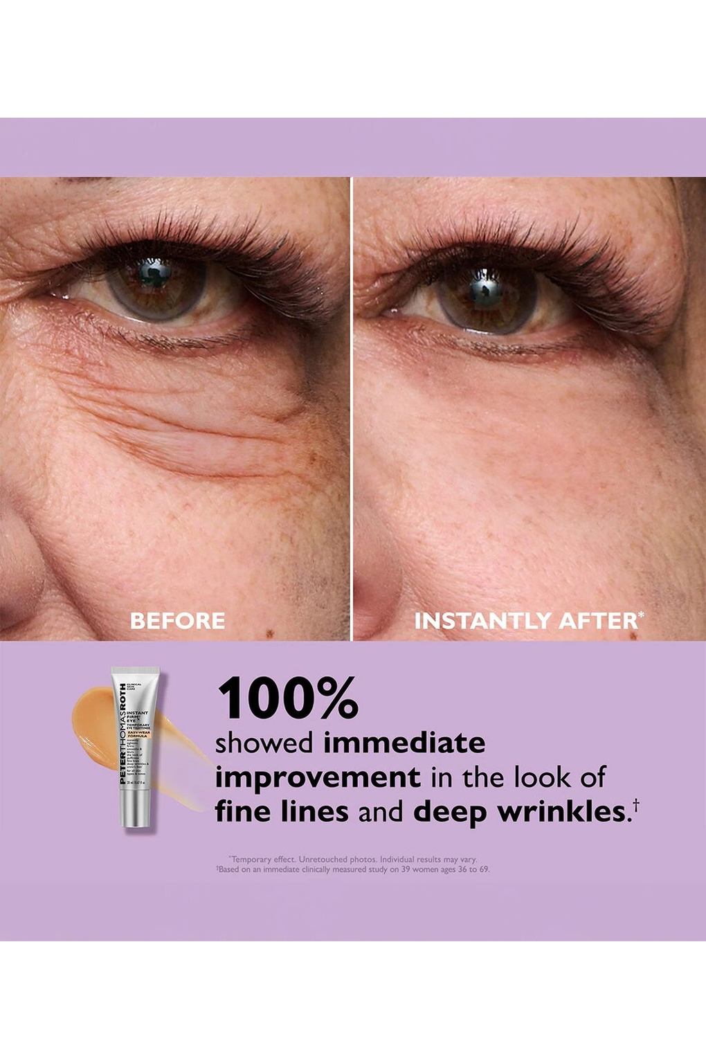 Гель для области вокруг глаз Peter Thomas Roth Instant FIRMx Temporary Eye Tightener New Easy-Wear Formula, 20 мл. Фото 4.