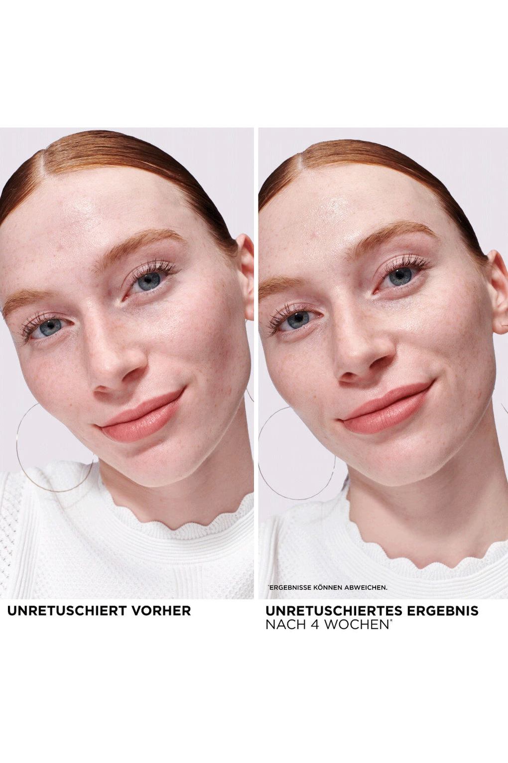 Сыворотка для лица Bye Bye Redness, 30 мл. Фото 2.
