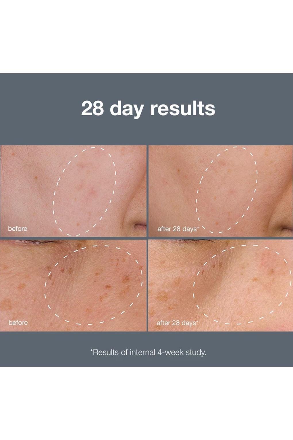 Набор уходовой косметики Dermalogica PowerBright Dark Spot System. Фото 4.