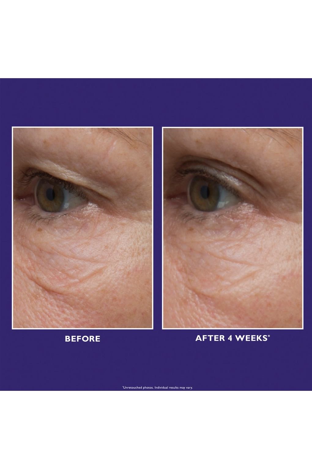 Крем для ухода за кожей Peter Thomas Roth Ultimate Solution 5 Multitasking Eye Cream, 15 мл. Фото 5.