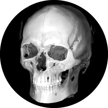 Диагностика челюстно-лицевой области (ЧЛО)