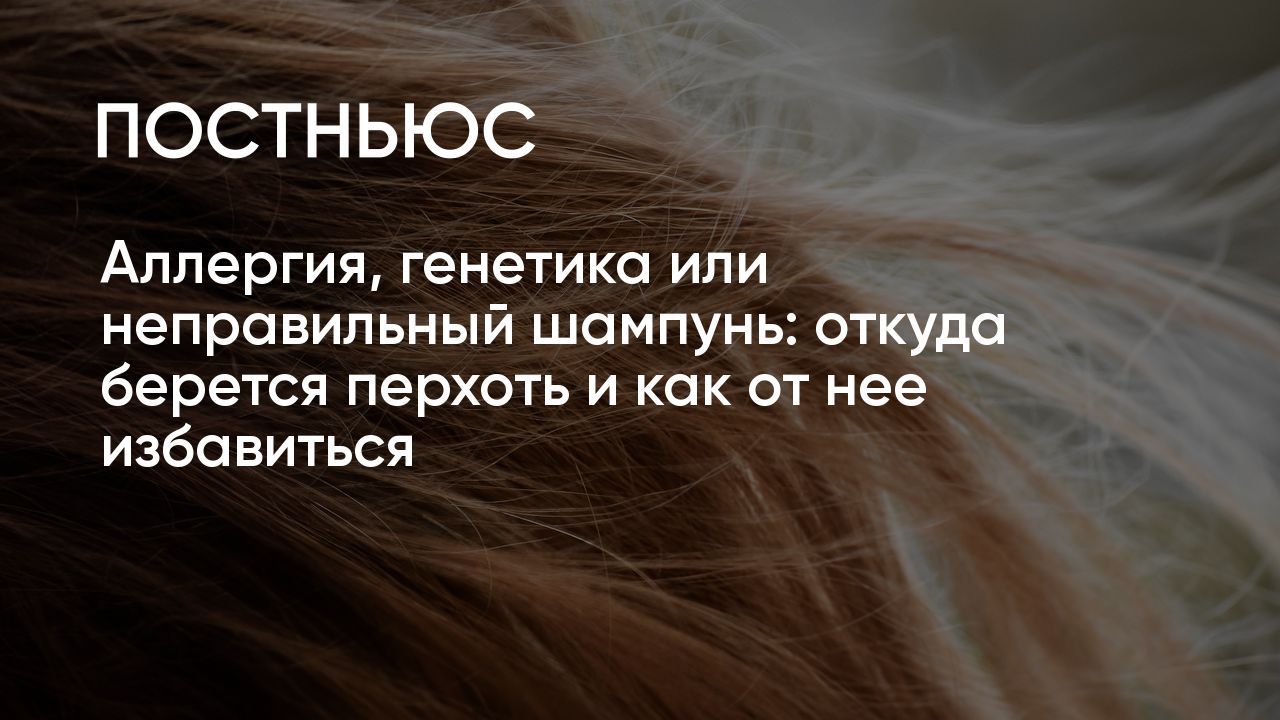 Аллергия, генетика или неправильный шампунь: откуда берется перхоть и как  от нее избавиться