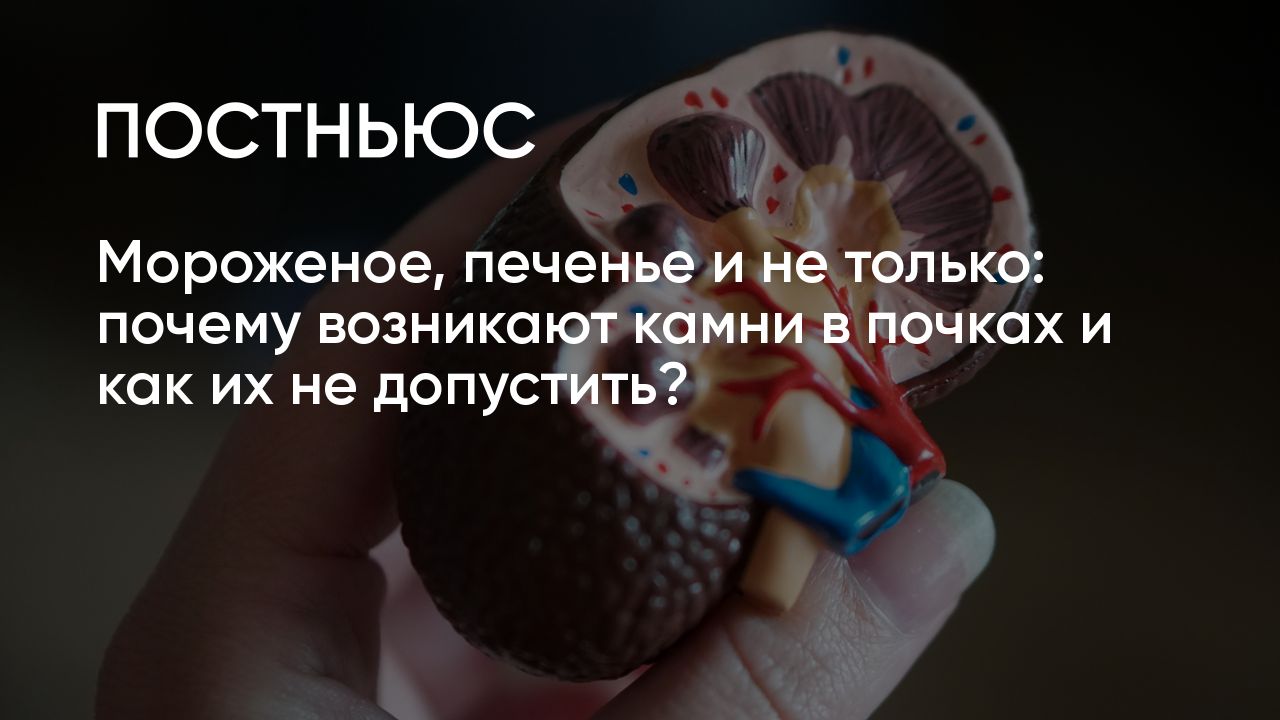 Мороженое, печенье и не только: почему возникают камни в почках и как их не  допустить?