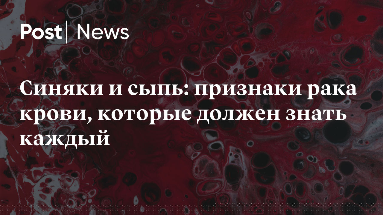 Характеристика сыпи