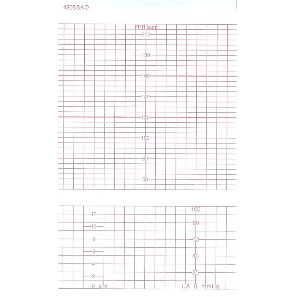 Лента тепл.регист. для CTG(FM) GE (COROMETRICS) BAO/DAO 151х90х150, K151Z90