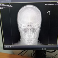 Александр, 37 лет, Скадовск